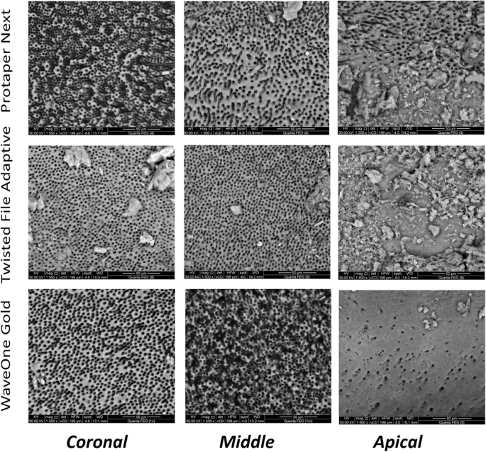 Cleaning ability of rotary NiTi systems with different kinematics