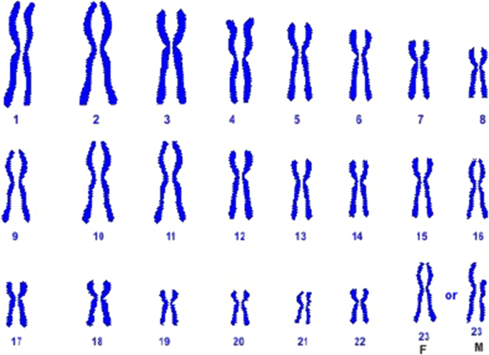 Mechanisms of ring chromosome formation, ring instability and clinical  consequences | BMC Medical Genetics | Full Text
