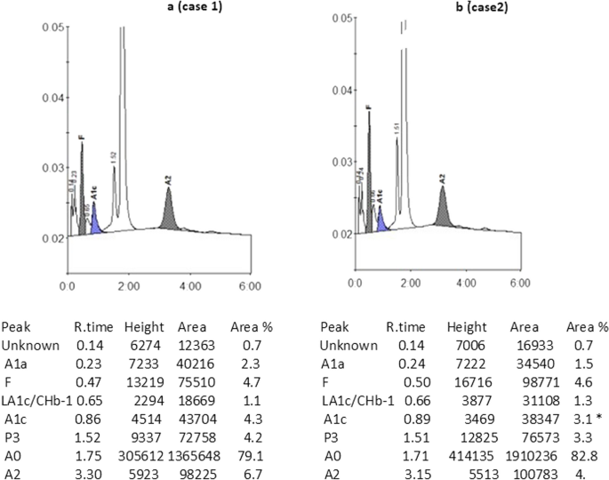 Two cases of vitamin B12 deficiency in patients with beta-thalassemia trait: lessons in diagnosis | Bulletin of the National Research Centre