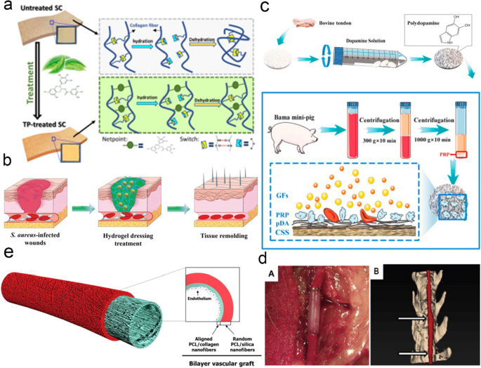 PDF) Identification of collagen-based materials that are supports