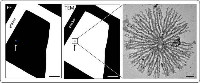 An intimate view into the silica deposition vesicles of diatoms, BMC  Materials