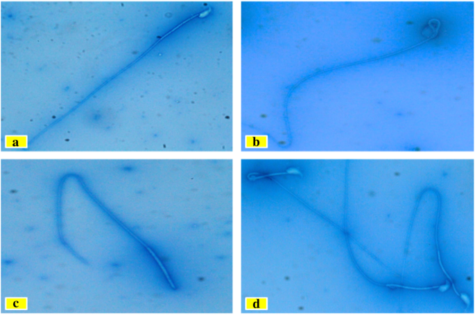 effect of cigarettes on sperm Assessment of the toxicity effects of nicotine on sperm and IVF and the  potential protective role of silymarin—an experimental study in mice |  Middle East Fertility Society Journal