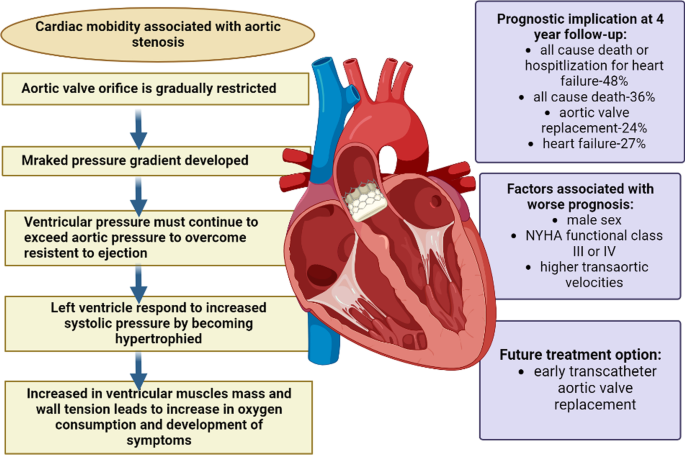Aortic stenosis: a review on acquired pathogenesis and ominous combination  with diabetes mellitus | The Egyptian Heart Journal | Full Text