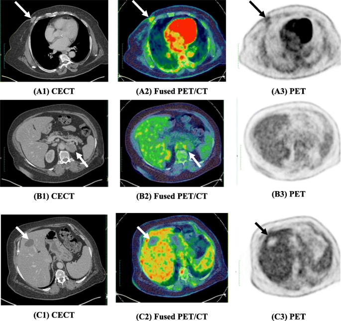 The diagnostic accuracy and clinical impact of FDG-PET/CT follow