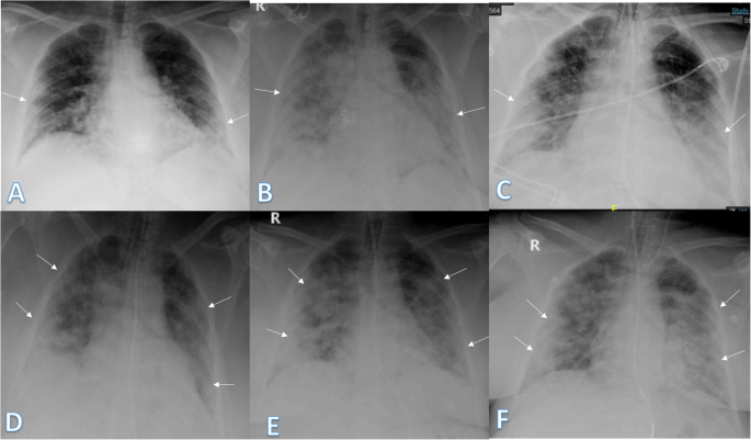 CXR Chess Rating Formulas Explained