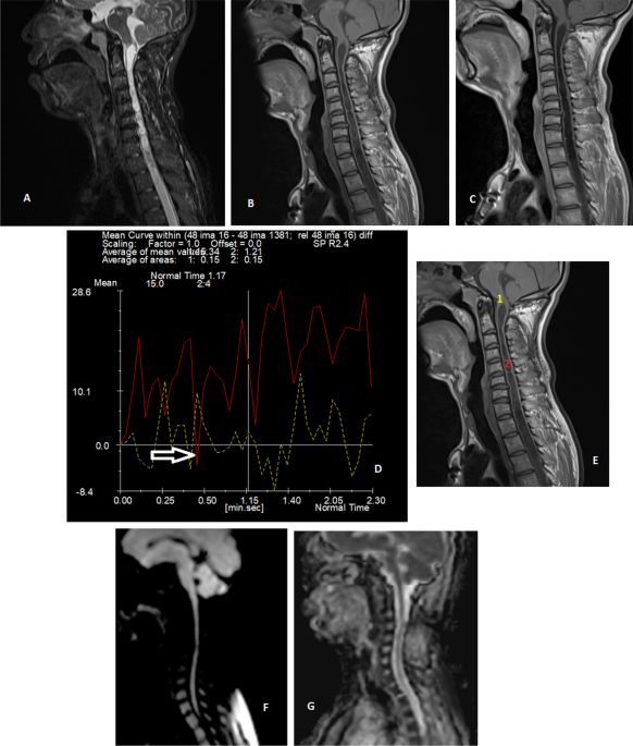 Magnetic Resonance Imaging Contrast Medium Injections Sagittal