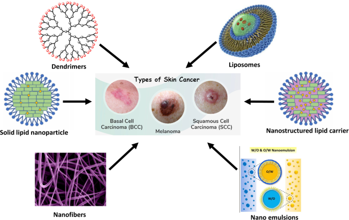 Nanodelivery systems for cutaneous melanoma treatment - ScienceDirect