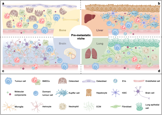 Basement membrane stiffness determines metastases formation