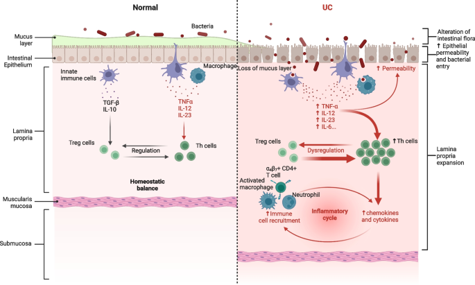 Ulcerative colitis: molecular insights and intervention therapy | Molecular  Biomedicine