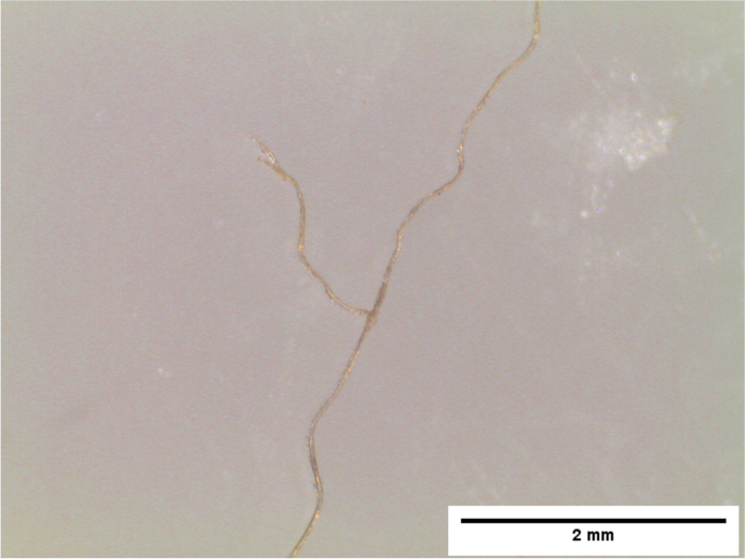 cigarette filter microplastic butts are an overlooked source of pollution Smokers' behaviour and the toxicity