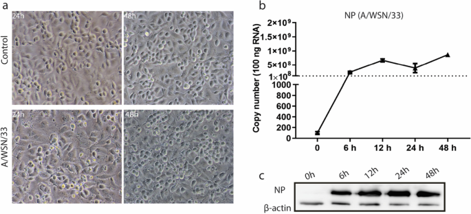 Altered gene expression in human brain microvascular endothelial cells in response to the infection of influenza H1N1 virus