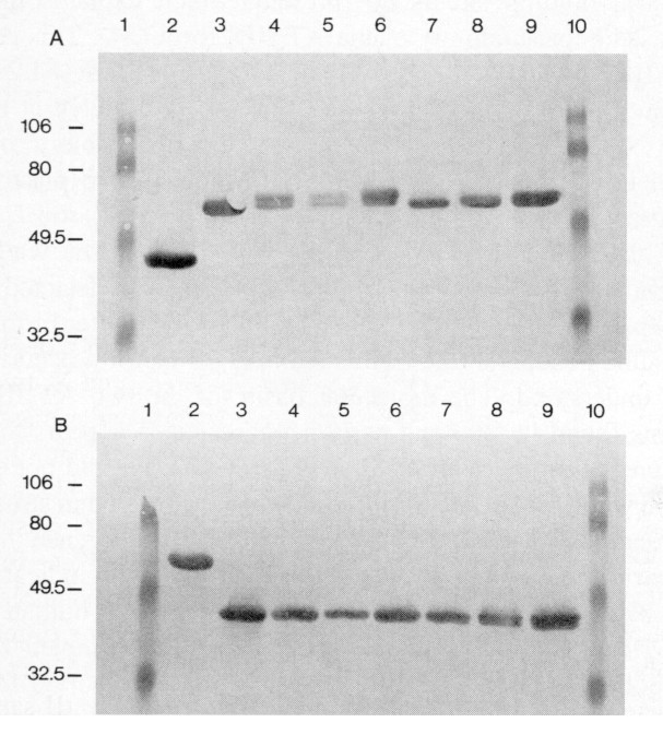 Fetal and Neonatal Development of Antithrombin III Plasma Activity and  Liver Messenger RNA Levels in Sheep | Pediatric Research