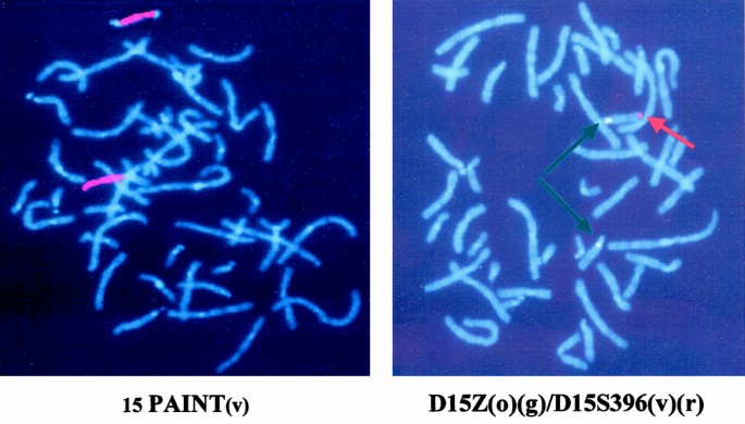 Igf-related proteins at birth in a case of antenatally diagnosed silver-russell syndrome