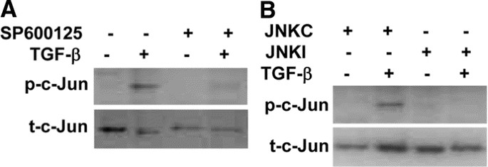 Inhibition of jnk enhances tgf-β1-activated smad2 signaling in mouse embryonic lung