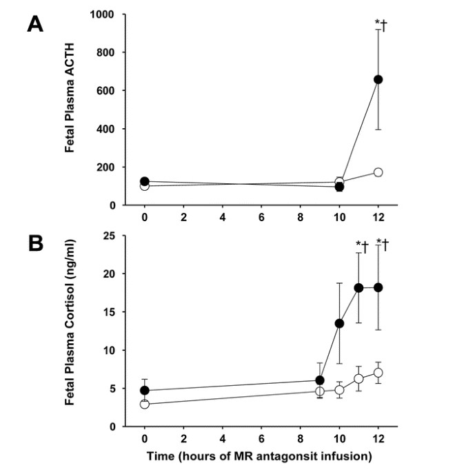 A Role For Mineralocorticoid Receptors In The Physiology Of The Ovine Fetus Effects On Acth And Lung Liquid Composition Pediatric Research A Role For Mineralocorticoid Receptors In The Physiology Of The Ovine Fetus Effects On Acth And Lung Liquid Composition Pediatric Research