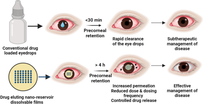 glutathione eye drops eye color change scientific evidence It's Your Color, Deal With It Color-changing eye drops: Are they
