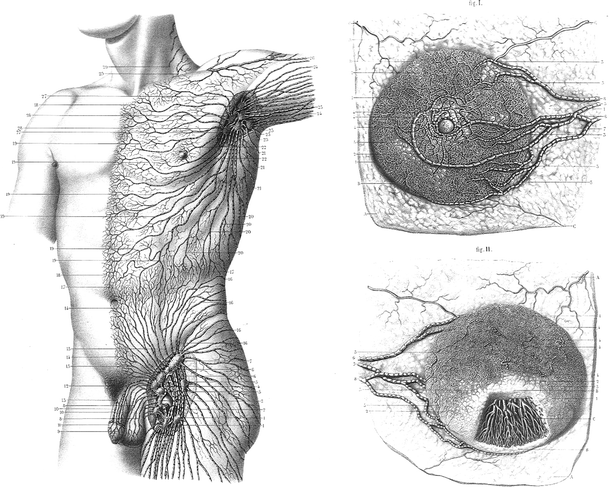 The Lymphatic Anatomy of the Breast and its Implications for