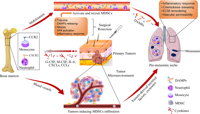 Modulation of myeloid and T cells in vivo by Bruton's tyrosine kinase  inhibitor ibrutinib in patients with metastatic pancreatic ductal  adenocarcinoma