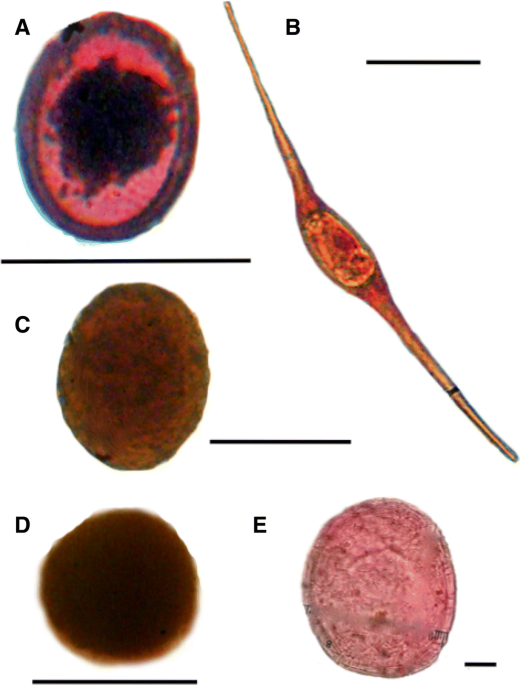 PDF) First report of a helminth infection for Bryde's whale Balaenoptera  edeni Anderson, 1878 (Cetacea, Balaenopteridae)