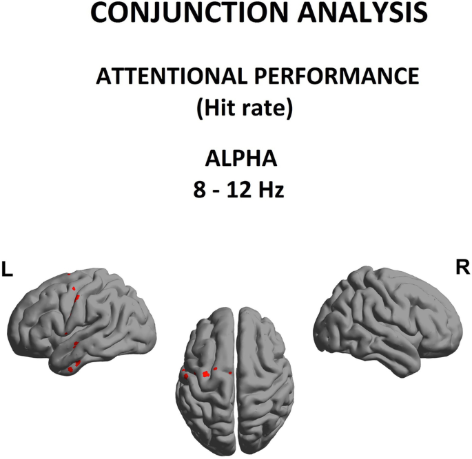 Altered brain structural and functional connectivity in cannabis users