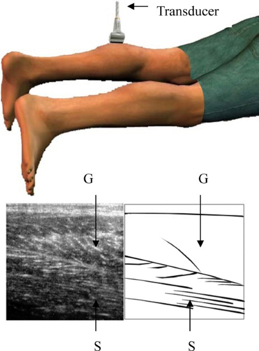 A novel approach to sonographic examination in a patient with a calf muscle  tear: a case report, Journal of Medical Case Reports