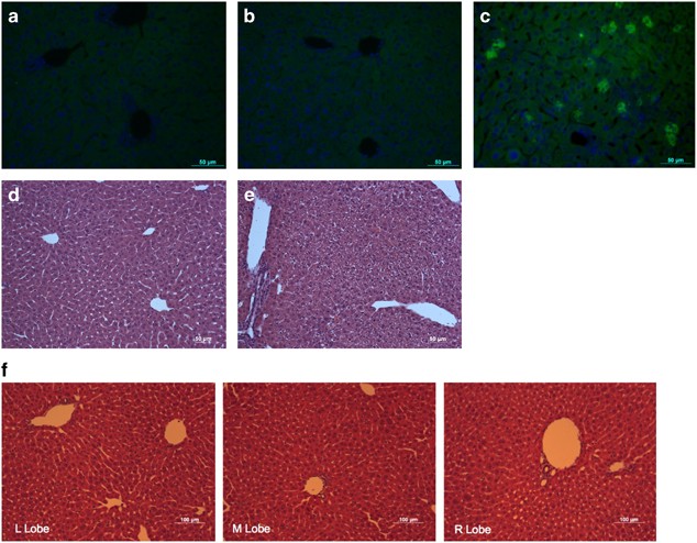 Ultrasoundtargeted hepatic delivery of factor IX in