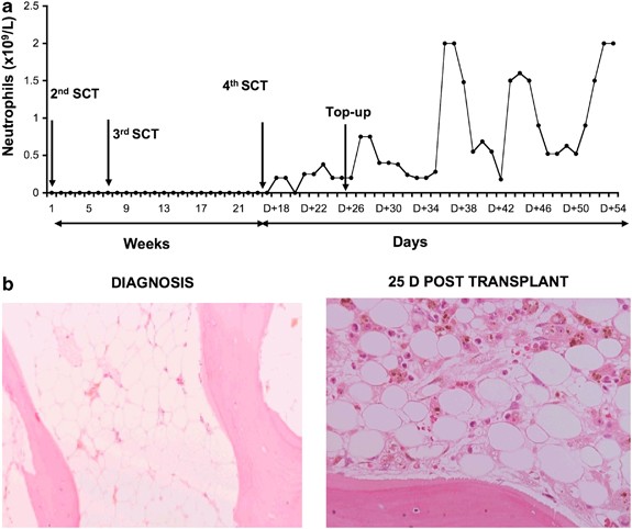 Effects of MSC co-injection on the reconstitution of ...