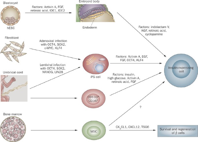 Stem cell therapy for type 1 diabetes mellitus Nature