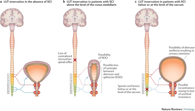 The management of neurogenic lower urinary tract