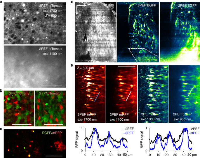 Dualcolor deeptissue threephoton microscopy with a multiband