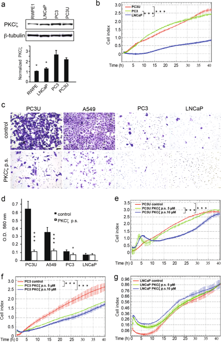 PKCζ facilitates lymphatic metastatic spread of prostate ... lymphatic cell diagram 
