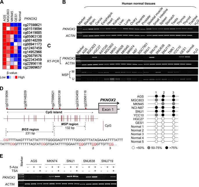 PKNOX2 suppresses gastric cancer through the 