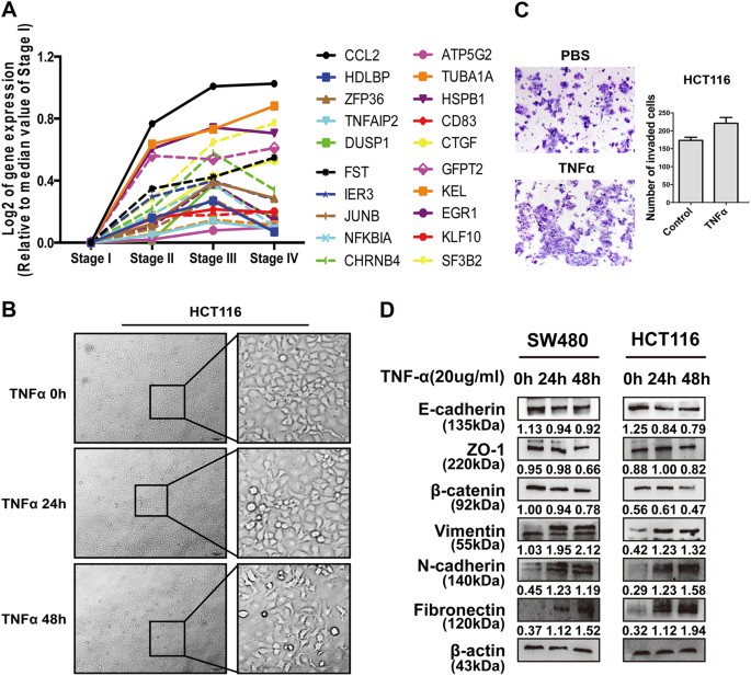 MicroRNA105 is involved in TNFαrelated tumor