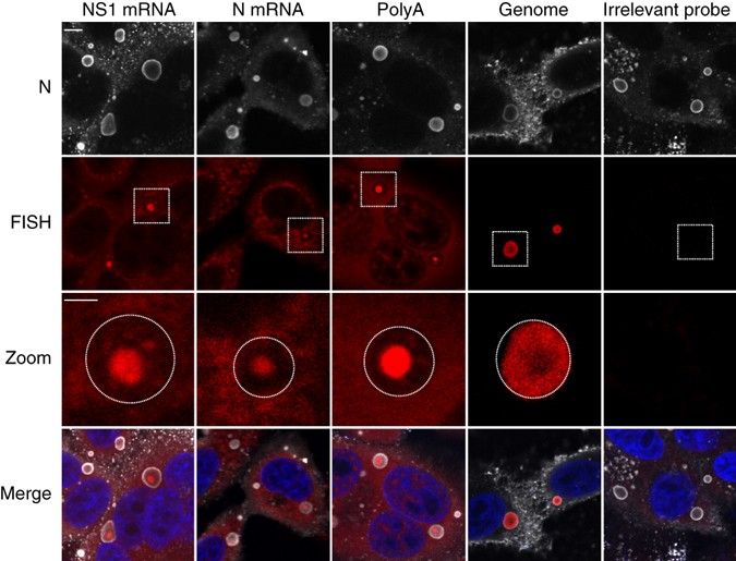 Functional organization of cytoplasmic inclusion bodies in cells