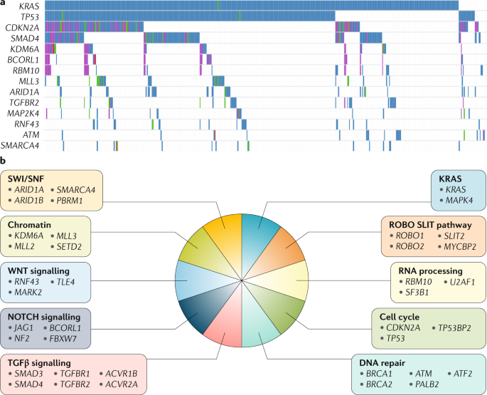 Molecular subtypes of pancreatic cancer | Nature Reviews ...