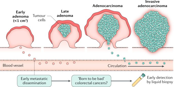 Does early metastatic seeding occur in colorectal cancer