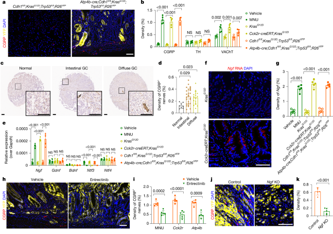 Nociceptive neurons promote gastric tumour progression via a CGRP–RAMP1 axis