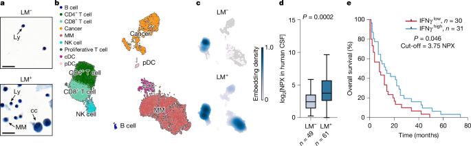 Interferon-γ orchestrates leptomeningeal anti-tumour response