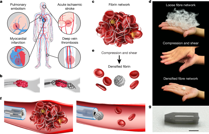 Milli-spinner thrombectomy