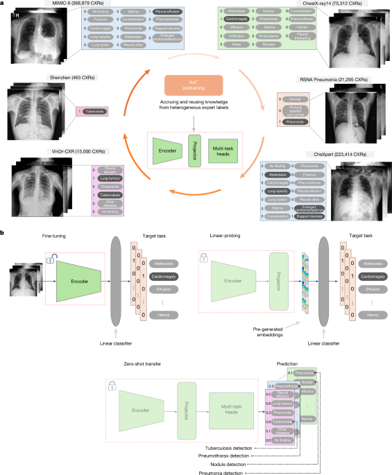 A fully open AI foundation model applied to chest radiography
