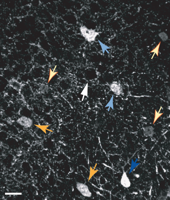 Author Correction: Parvalbumin-expressing basket-cell network plasticity induced by experience regulates adult learning