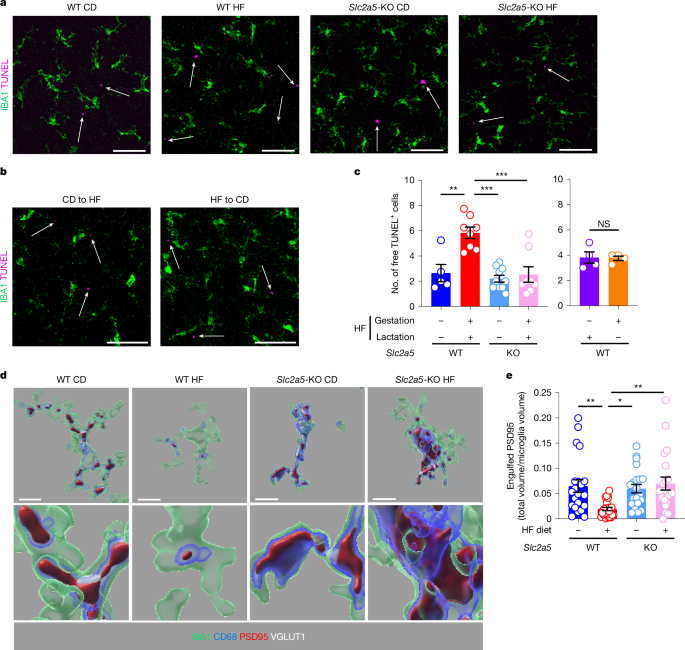 Early life high fructose impairs microglial phagocytosis and neurodevelopment