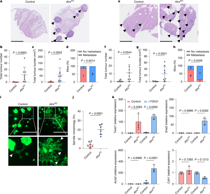 Loss of colonic fidelity enables multilineage plasticity and metastasis