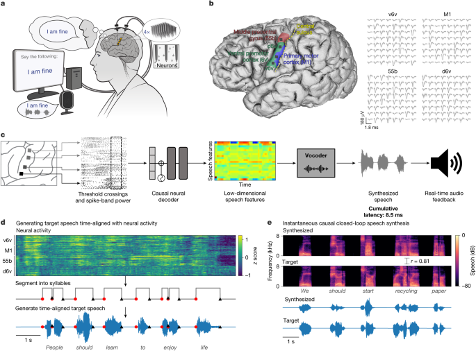 An instantaneous voice-synthesis neuroprosthesis