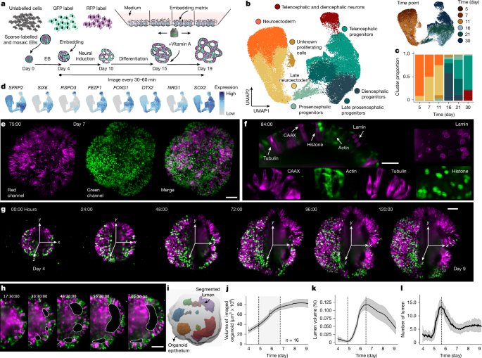 Morphodynamics of human early brain organoid development