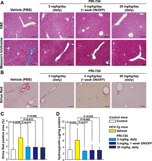 Selective inhibitor of Wnt/β-catenin/CBP signaling ...