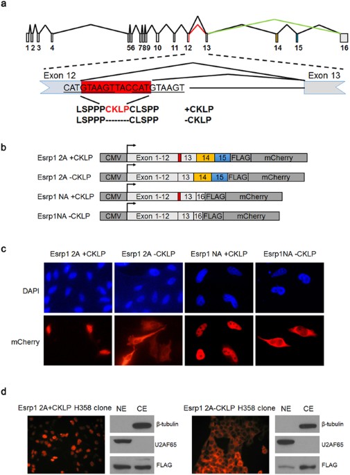 alternative splicing regulates distinct subcellular turn off cell