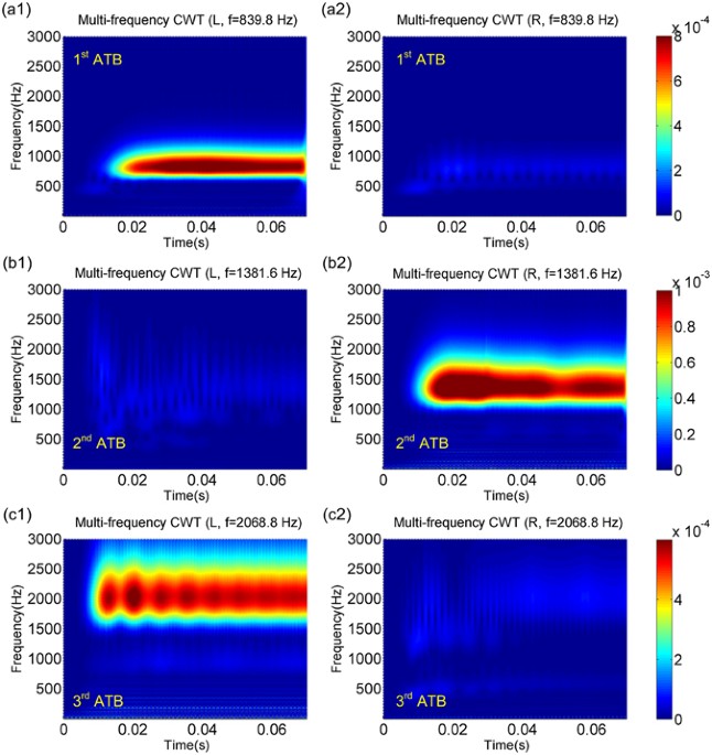A diatomic elastic metamaterial for tunable asymmetric wave
