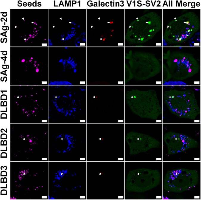 Impaired endolysosomal membrane integrity accelerates the seeding
