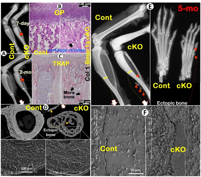 Chondrogenesis and osteogenesis are one continuous developmental and ...